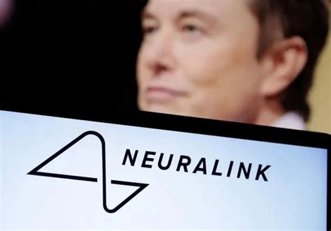 Neuralink Implanta Primer Chip Cerebral En Humano Para Controlar