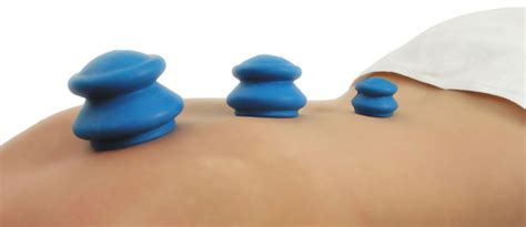 Cupping Therapy