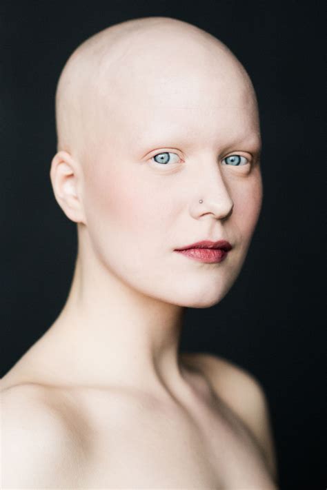 7 Retratos Impressionantes De Mulheres Alopecia Redefinem A