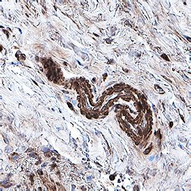 Hydroxynonenal Antibody Mab Bio Techne