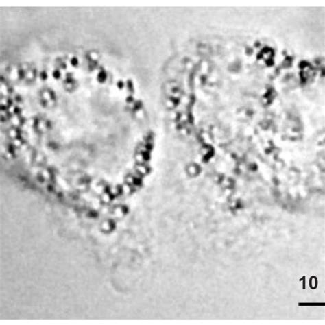 Phase Contrast Image Of The A431 Cells Before Laser Illumination Note