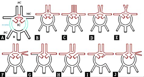 Schematic Drawing Of The Anatomic Segments Of The