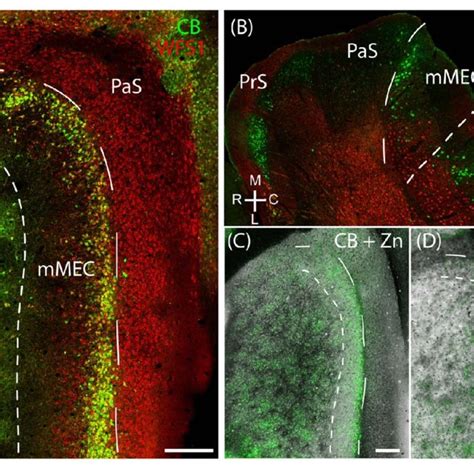 Cellular Structure Of Layer 2 Of Medial Entorhinal Cortex Calbindin