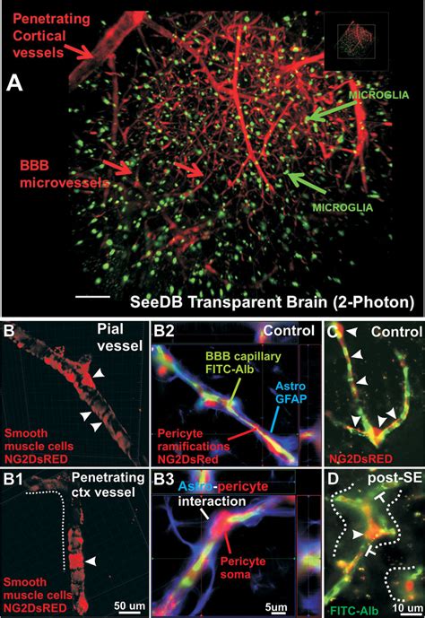 Endothelial Mural Cells Interface And Plasticity In Epilepsy A