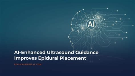 Ai Enhanced Ultrasound Guidance Improves Epidural Placement Rivanna