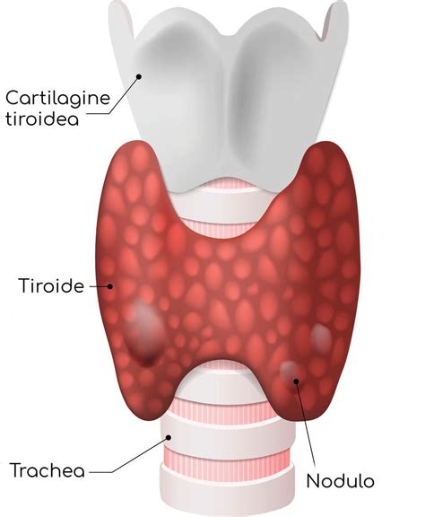 Noduli Alla Tiroide Sintomi E Quando Preoccuparsi Valori Normali