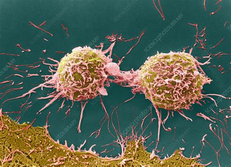 SEM Of Cervical Cancer Cells Dividing Stock Image M850 0339