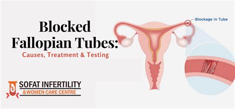 What Causes Blockage In The Fallopian Tubes How Can It Be Tested And Treated