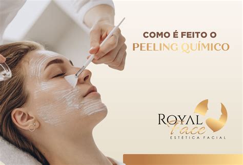 Como é Feito O Peeling Químico Royal Face