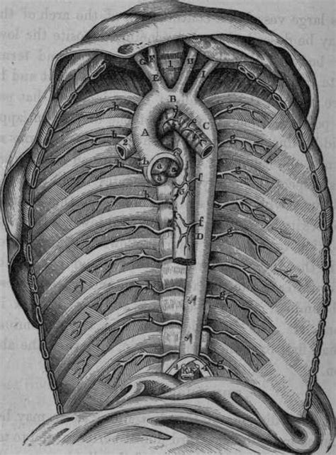 Thoracic Aneurysm Dissection Uwmtap 51 Off