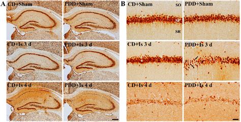 Antibodies in IHC Staining of the Brain 
