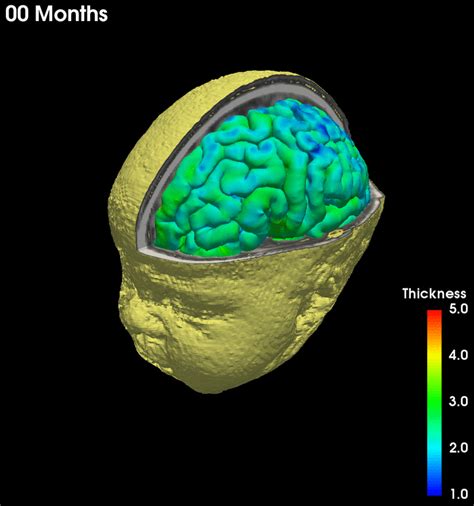 Research Unc Brain Lab