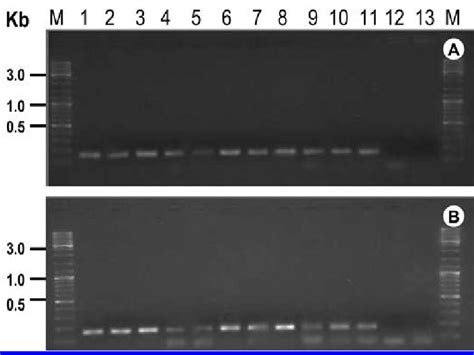 Agarose Gels Showing Amplification Products From Polymerase Chain