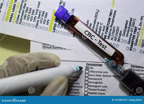 Cbc Test With Blood Sample Top View Isolated On Office Desk Stock