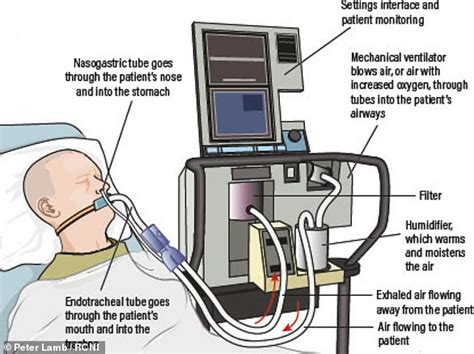 How New York Is Using Bipap Machines As Ventilators Daily Mail Online