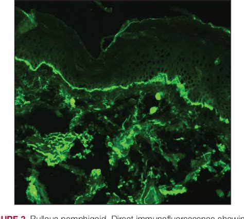 Figure 1 From Extensive Erosions And Ulcerations On The Trunk And Extremities In A Neonate