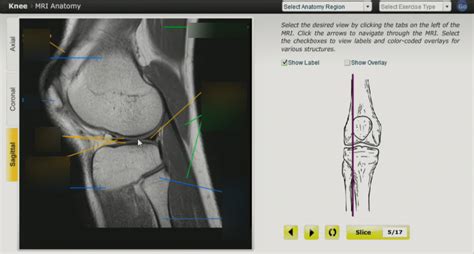 Knee Mri Sagittal Slice 4 Diagram Quizlet