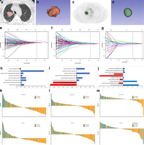 Construction Of Radiomics Signatures Rss A B Ct Roi Segmentation Download Scientific