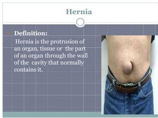 Hernias And Its Type And Sign Symptome Treatment Ppt