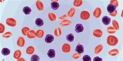 A Breakthrough For Acute Leukemia Patients