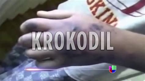 Krokodil La Droga Che Ti Consuma La Carne Antimediaitalia Blogspot