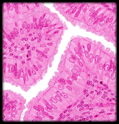 Simple Columnar Epithelium (ciliated) Diagram | Quizlet