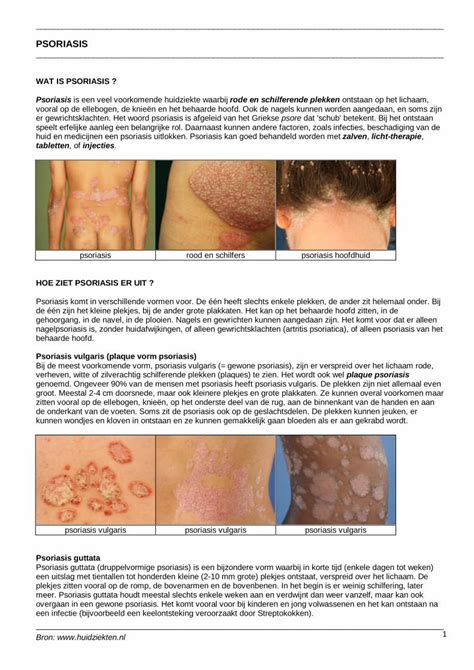 PDF Psoriasis Behandeling Van Psoriasis Psoriasis Guttatapsoriasis