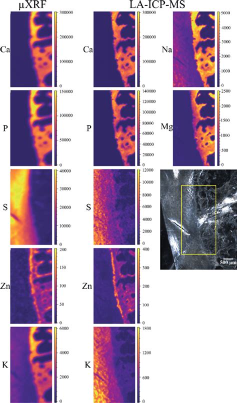 41 Mm Slice Elemental Maps Obtained By Mxrf And La Icp Ms The Download Scientific Diagram