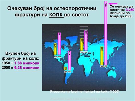 Да ги сакаме и чуваме нашите коски - ppt download