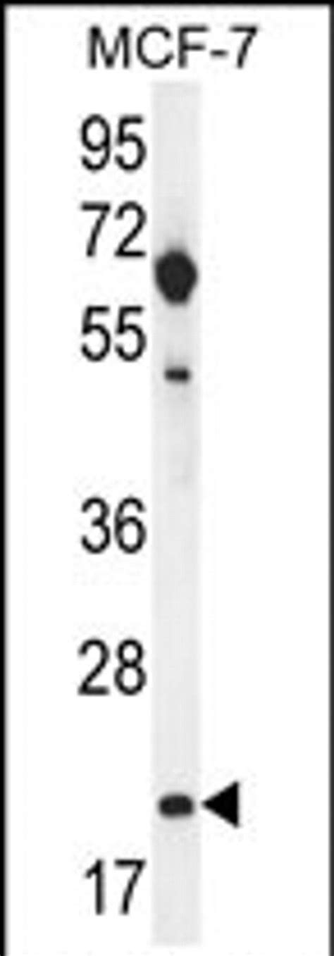 Claudin Rabbit Anti Human Polyclonal Invitrogen L