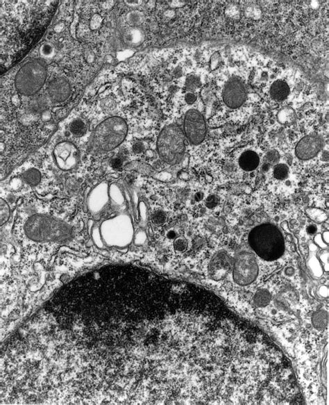 Photograph Fine Structure Of Islet Cell Tem Science Source Images