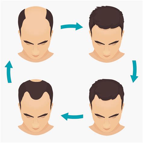 Hair Loss In Men Bioscor International