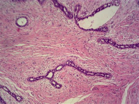 Sample Segmentation Results 1 A Original Microscopic Mammary Gland