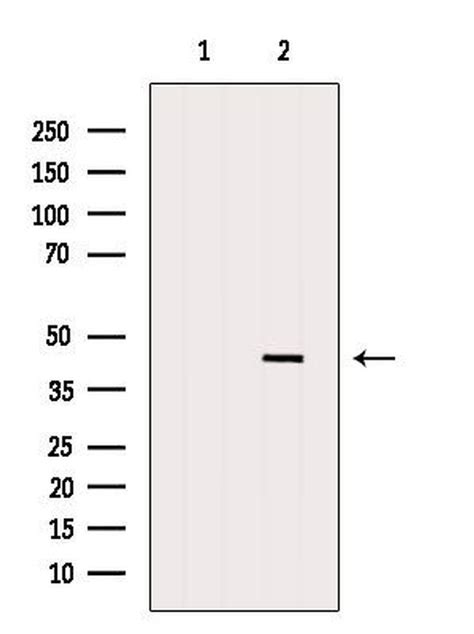 Hla Abc Polyclonal Antibody Pa5 104359