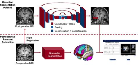 Pipelines For Automated Resection Segmentation And Quantification Of