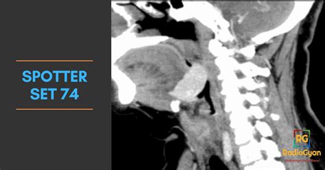 Spotters Set Mixed Bag Radiology Cases Radiogyan