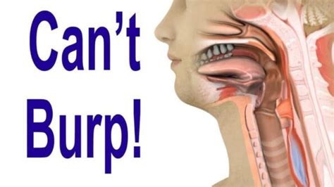 The Inability To Burp R Cpd