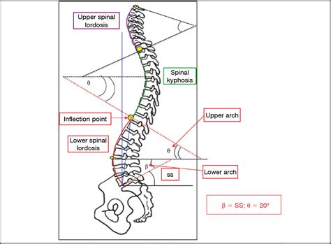 Scielo Brasil Impact Of The Sitting Position On Lumbar Lordosis And