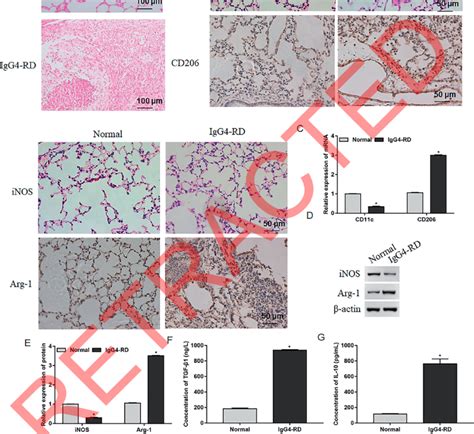 M2 polarization of alveolar macrophages was increased in IgG4-RD. (A ...