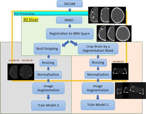 Image Level Detection Of Large Vessel Occlusion On 4d Cta Perfusion