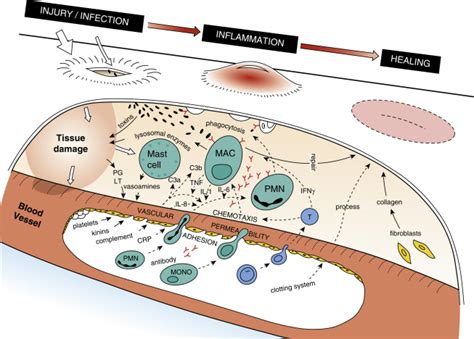 Inflammation And Infection Radiology Key