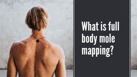 What Is Full Body Mole Mapping The Clinic