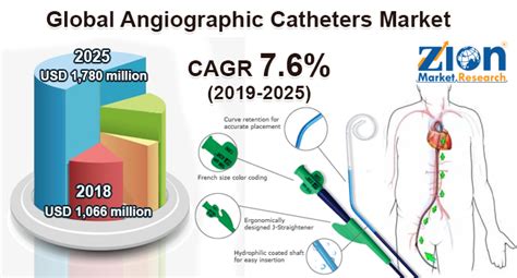 Angiographic Catheters Market Size Share Growth Segment Analysis