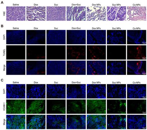 Pharmaceutics Free Full Text PLGA Nanoparticles Containing VCAM 1