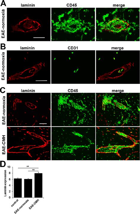 CMH Promotes Increased Laminin Expression In The Vascular Basement