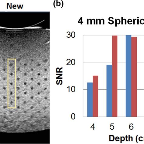 Signal‐to‐noise Ratio Measurements With A Pair Of Example Phantom