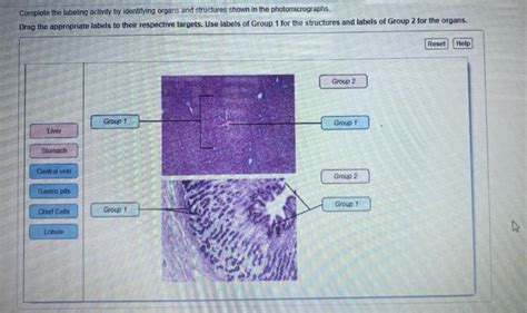 Solved Complete The Labeling Activity By Identifying Organs Chegg