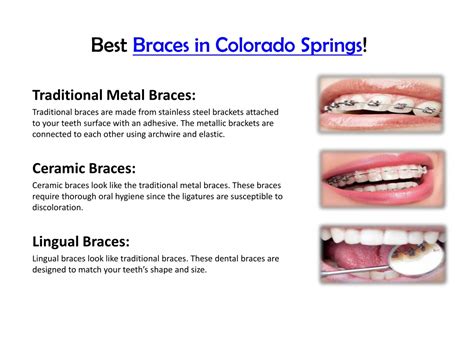 PPT Colorado Springs Orthodontist PowerPoint Presentation Free