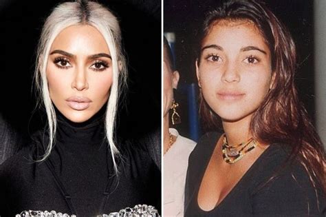 Kim Kardashian Plastic Surgery Before And After