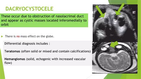 Congenital Anomalies Of Head Neck And Face Radiology Including Usg And